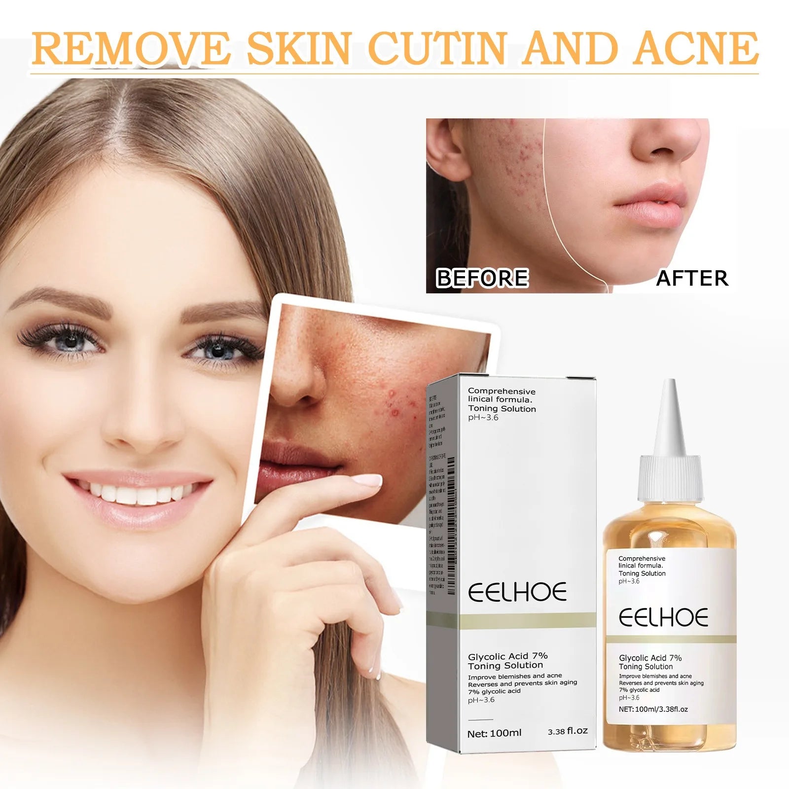 Glycolic Acid 7% Toning Solution – Acne & Anti-Aging