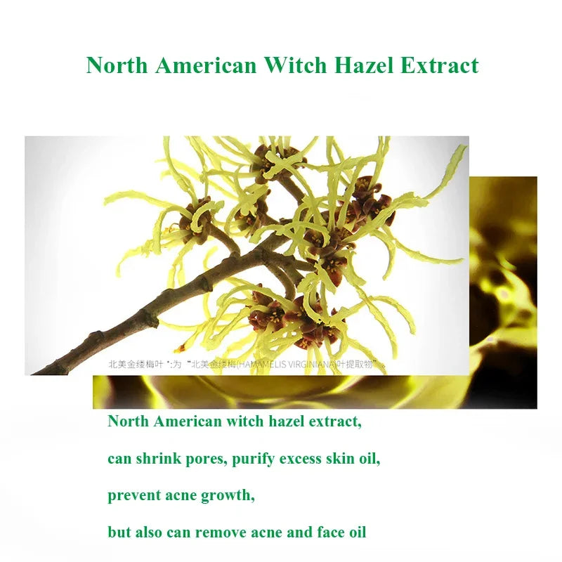 Herbal Acne Treatment Cream – Blackhead & Scar Repair