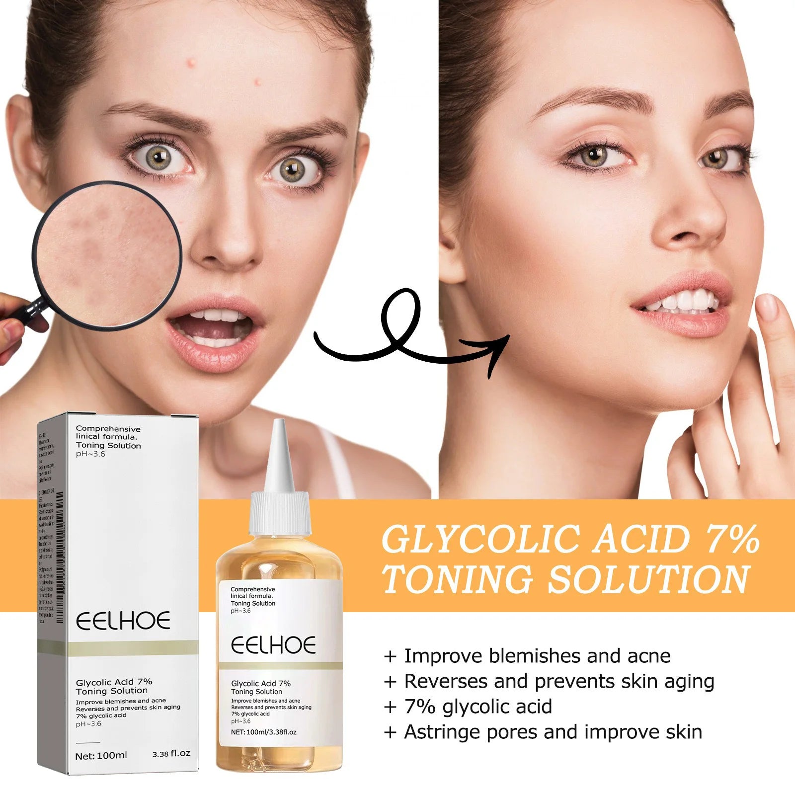 Glycolic Acid 7% Toning Solution – Acne & Anti-Aging