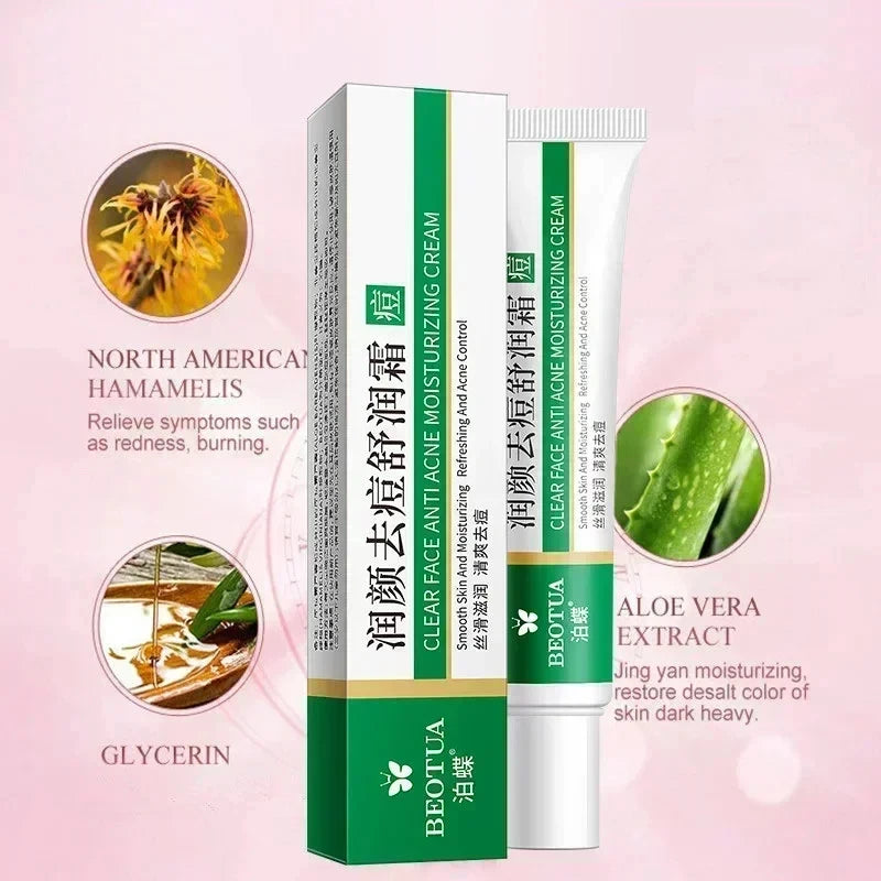 Herbal Acne Treatment Cream – Blackhead & Scar Repair